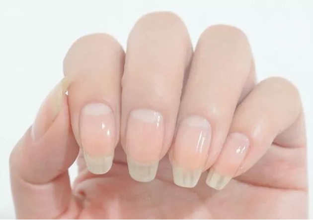 手指上月牙的多少真的与健康有关吗?